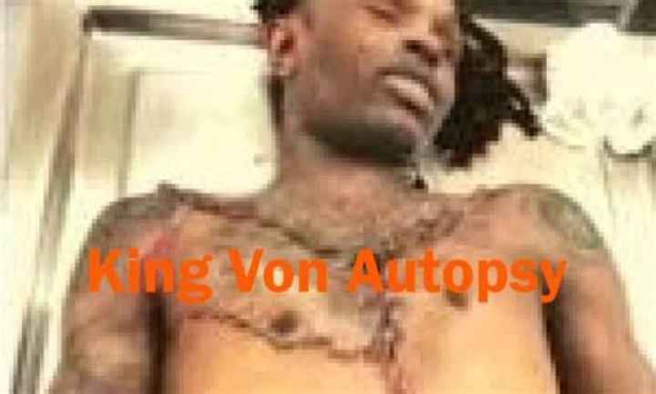 King Von Autopsy: Unraveling the Truth Behind the Tragic Death
